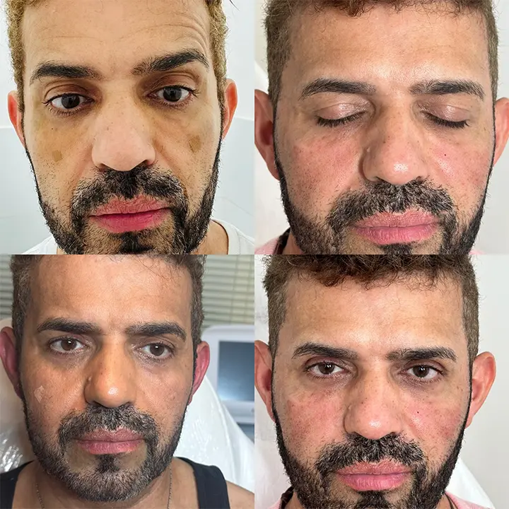 AnyConv.com__facial-2