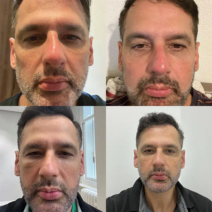 AnyConv.com__facial-3