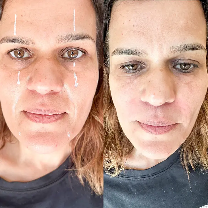 AnyConv.com__facial-4